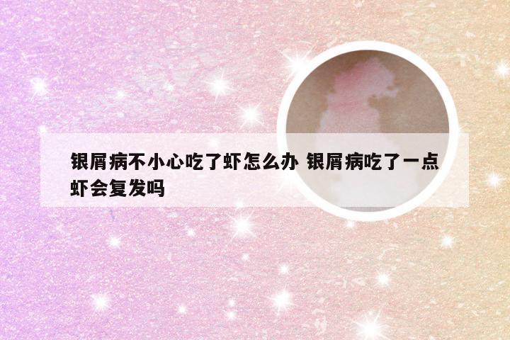 银屑病不小心吃了虾怎么办 银屑病吃了一点虾会复发吗