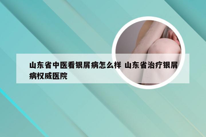 山东省中医看银屑病怎么样 山东省治疗银屑病权威医院