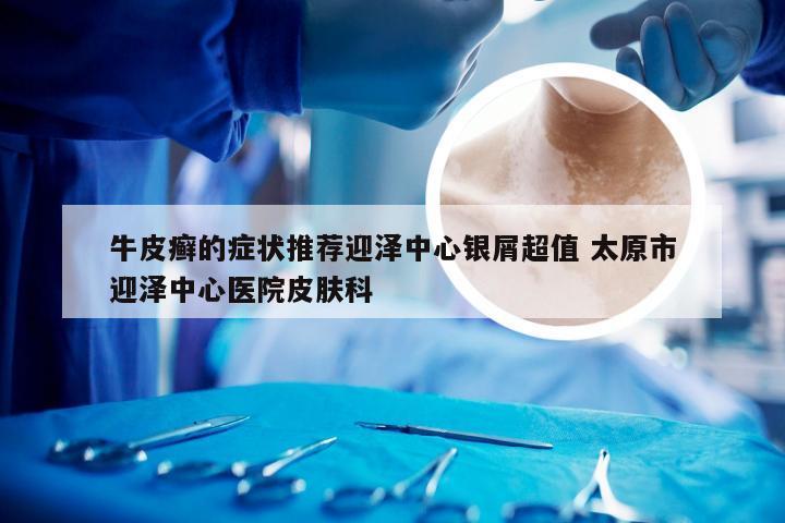 牛皮癣的症状推荐迎泽中心银屑超值 太原市迎泽中心医院皮肤科