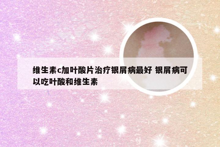 维生素c加叶酸片治疗银屑病最好 银屑病可以吃叶酸和维生素