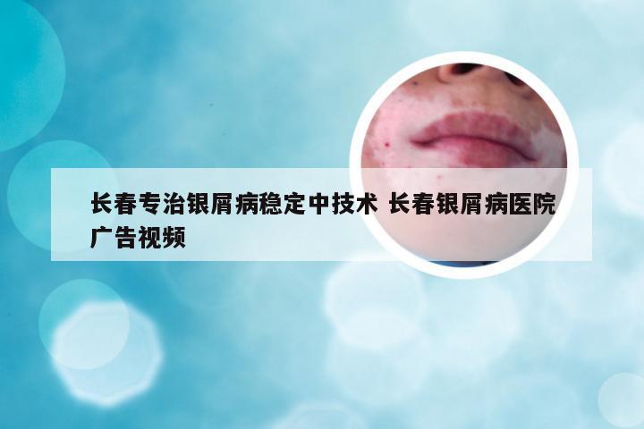 长春专治银屑病稳定中技术 长春银屑病医院广告视频