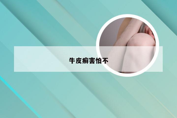 牛皮癣害怕不
