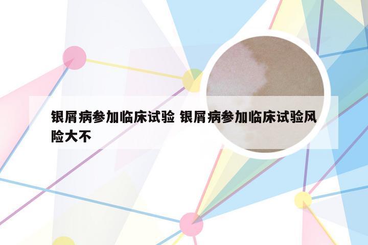 银屑病参加临床试验 银屑病参加临床试验风险大不