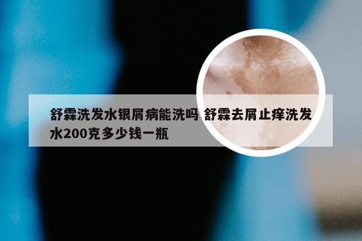 舒霖洗发水银屑病能洗吗 舒霖去屑止痒洗发水200克多少钱一瓶