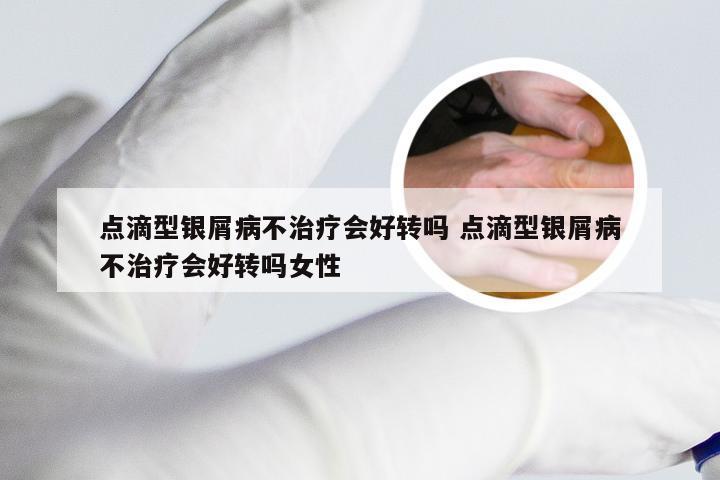 点滴型银屑病不治疗会好转吗 点滴型银屑病不治疗会好转吗女性