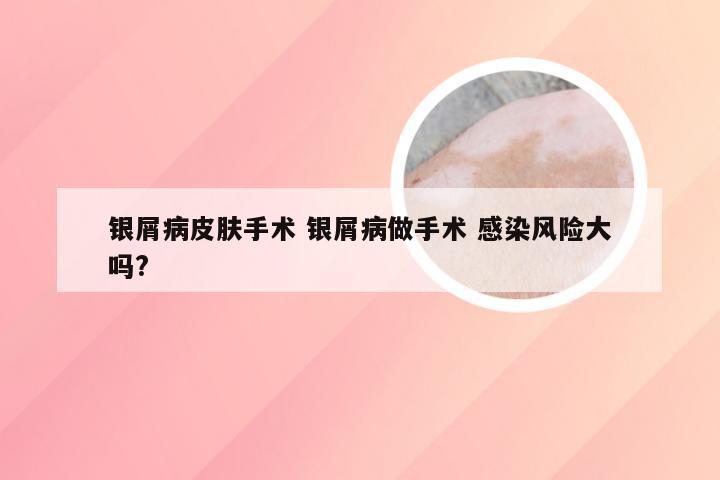 银屑病皮肤手术 银屑病做手术 感染风险大吗?