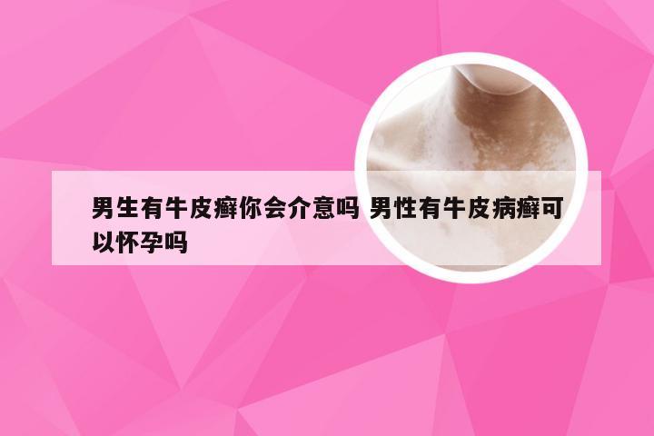 男生有牛皮癣你会介意吗 男性有牛皮病癣可以怀孕吗