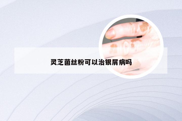 灵芝菌丝粉可以治银屑病吗