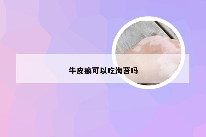 牛皮癣可以吃海苔吗