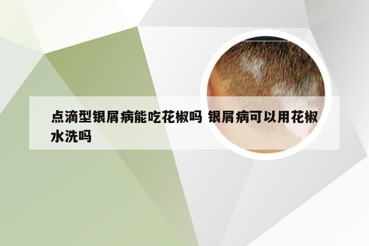 点滴型银屑病能吃花椒吗 银屑病可以用花椒水洗吗
