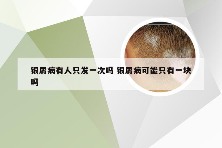银屑病有人只发一次吗 银屑病可能只有一块吗