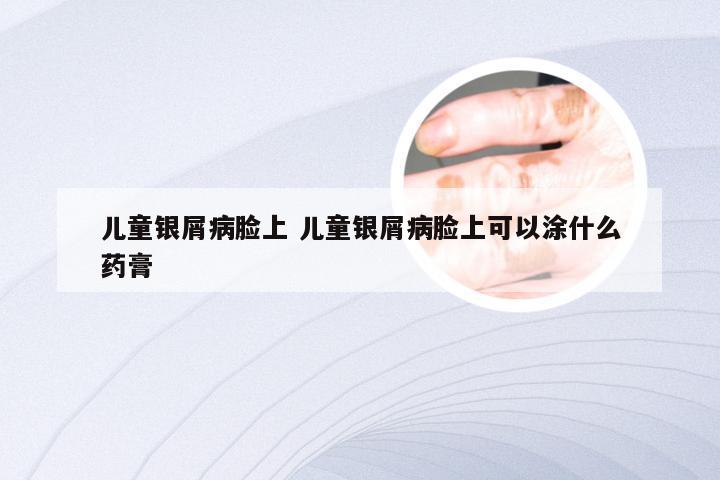 儿童银屑病脸上 儿童银屑病脸上可以涂什么药膏