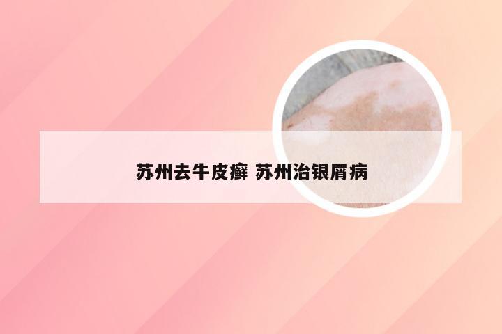 苏州去牛皮癣 苏州治银屑病