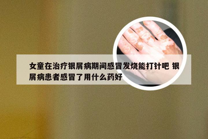 女童在治疗银屑病期间感冒发烧能打针吧 银屑病患者感冒了用什么药好