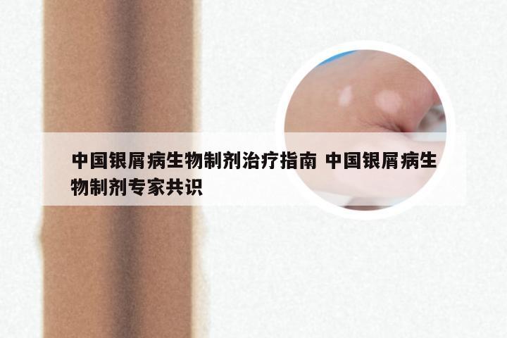 中国银屑病生物制剂治疗指南 中国银屑病生物制剂专家共识