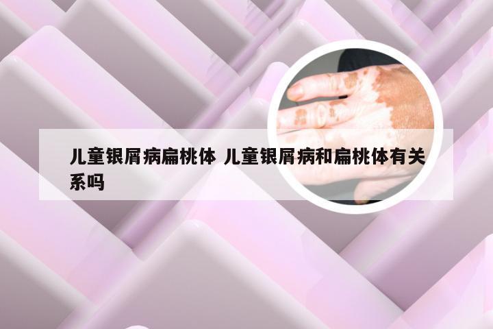 儿童银屑病扁桃体 儿童银屑病和扁桃体有关系吗