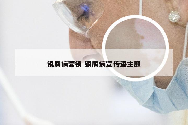 银屑病营销 银屑病宣传语主题