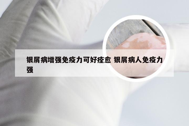 银屑病增强免疫力可好痊愈 银屑病人免疫力强