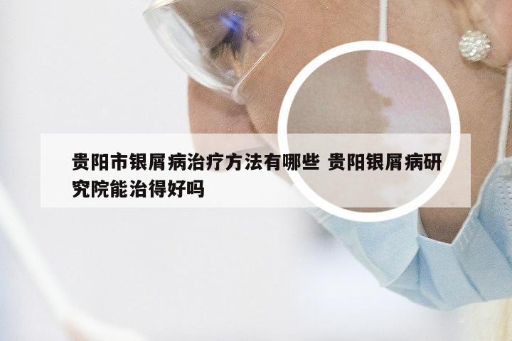 贵阳市银屑病治疗方法有哪些 贵阳银屑病研究院能治得好吗