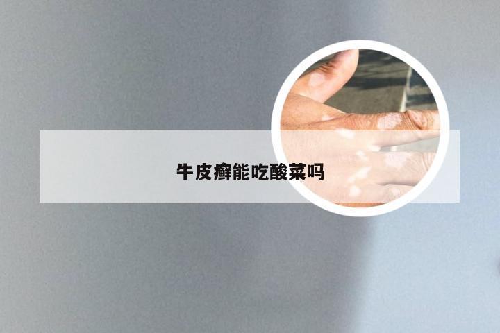 牛皮癣能吃酸菜吗