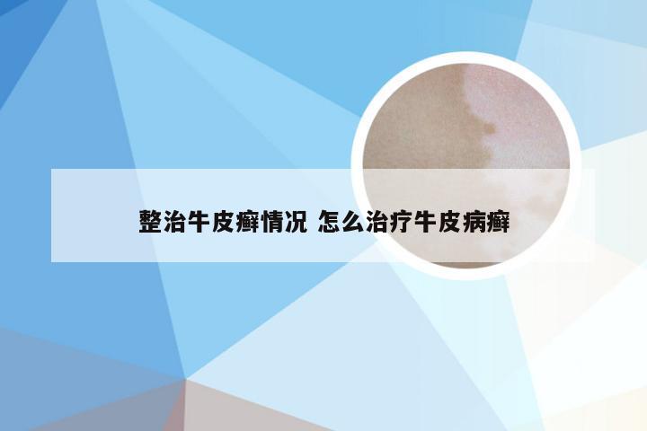 整治牛皮癣情况 怎么治疗牛皮病癣