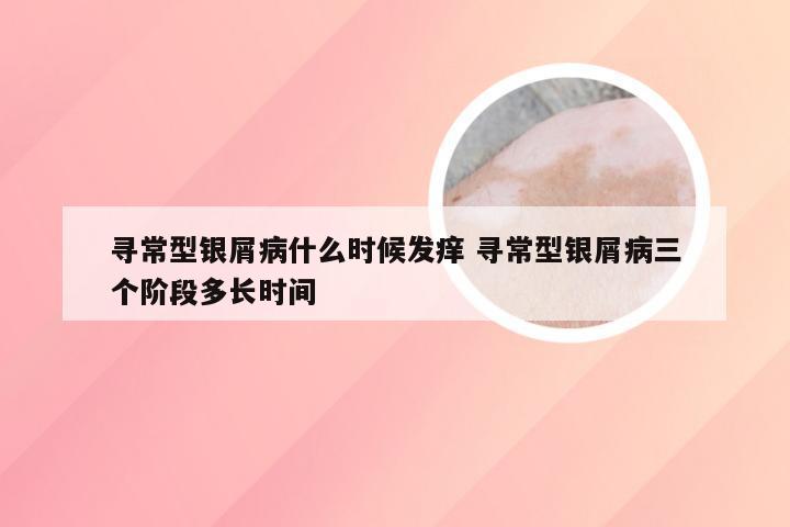 寻常型银屑病什么时候发痒 寻常型银屑病三个阶段多长时间