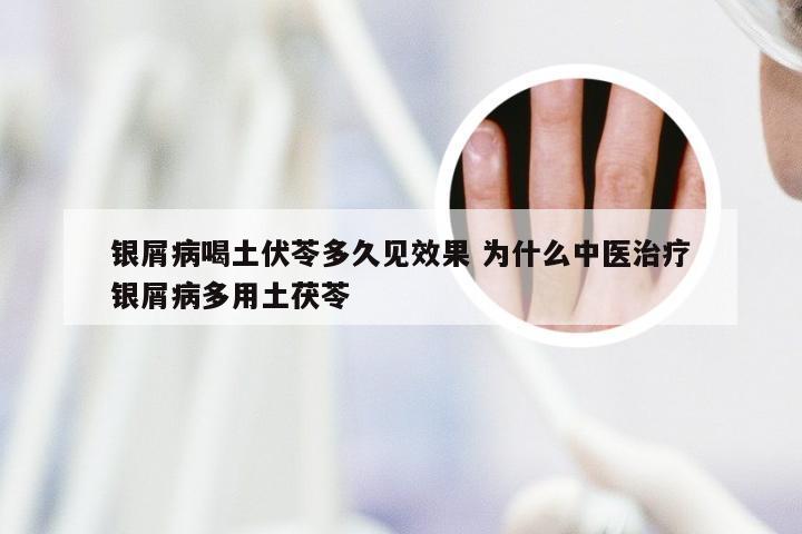 银屑病喝土伏苓多久见效果 为什么中医治疗银屑病多用土茯苓