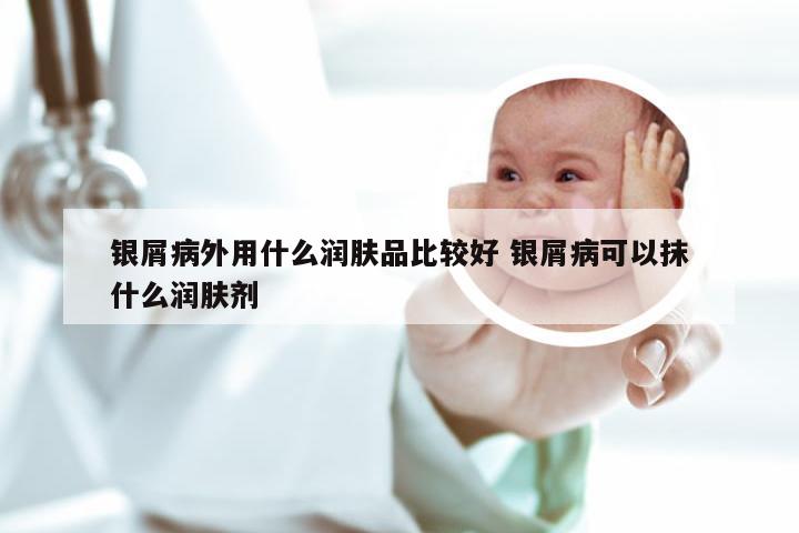银屑病外用什么润肤品比较好 银屑病可以抹什么润肤剂