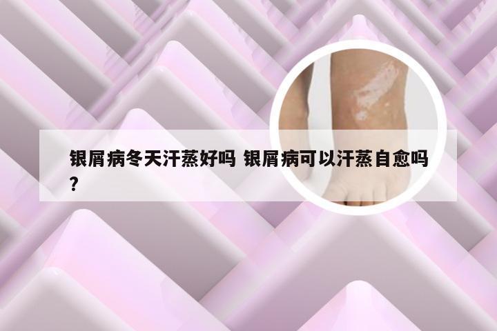 银屑病冬天汗蒸好吗 银屑病可以汗蒸自愈吗?