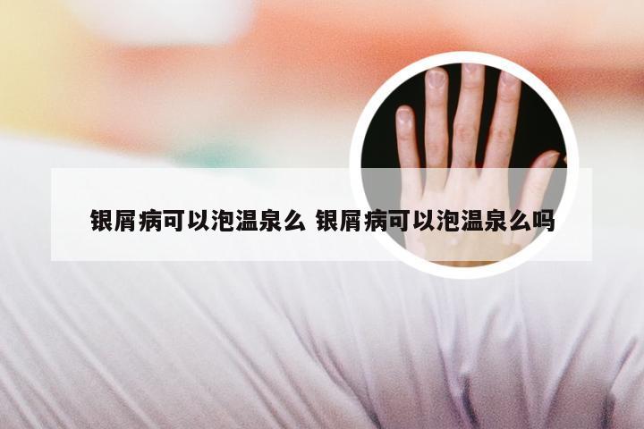 银屑病可以泡温泉么 银屑病可以泡温泉么吗