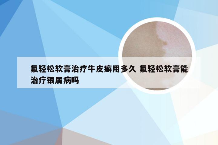 氟轻松软膏治疗牛皮癣用多久 氟轻松软膏能治疗银屑病吗