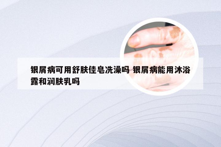 银屑病可用舒肤佳皂冼澡吗 银屑病能用沐浴露和润肤乳吗