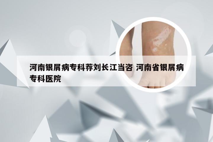 河南银屑病专科荐刘长江当咨 河南省银屑病专科医院
