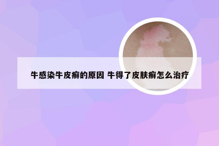 牛感染牛皮癣的原因 牛得了皮肤癣怎么治疗