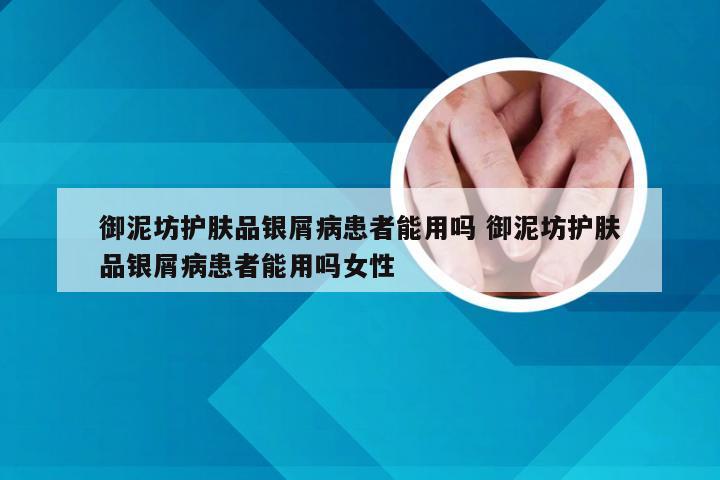 御泥坊护肤品银屑病患者能用吗 御泥坊护肤品银屑病患者能用吗女性