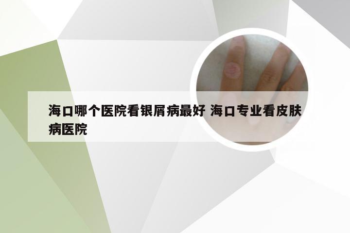 海口哪个医院看银屑病最好 海口专业看皮肤病医院