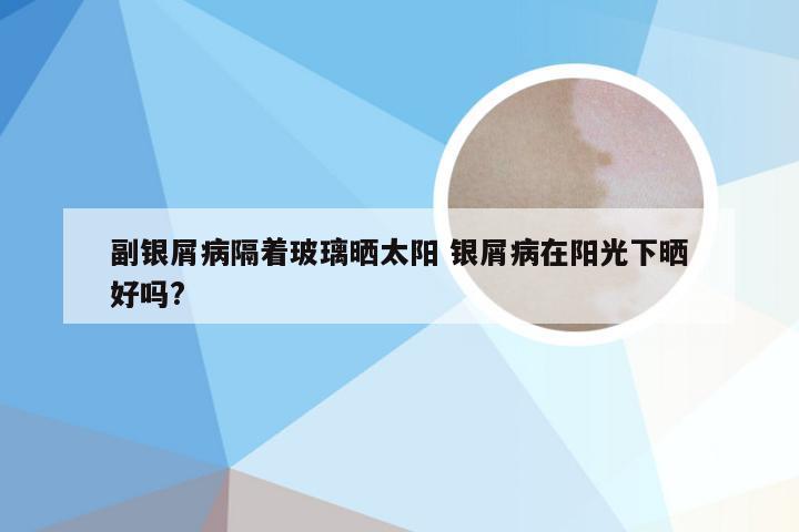 副银屑病隔着玻璃晒太阳 银屑病在阳光下晒好吗?