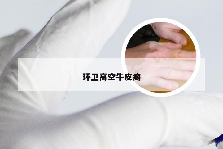 环卫高空牛皮癣