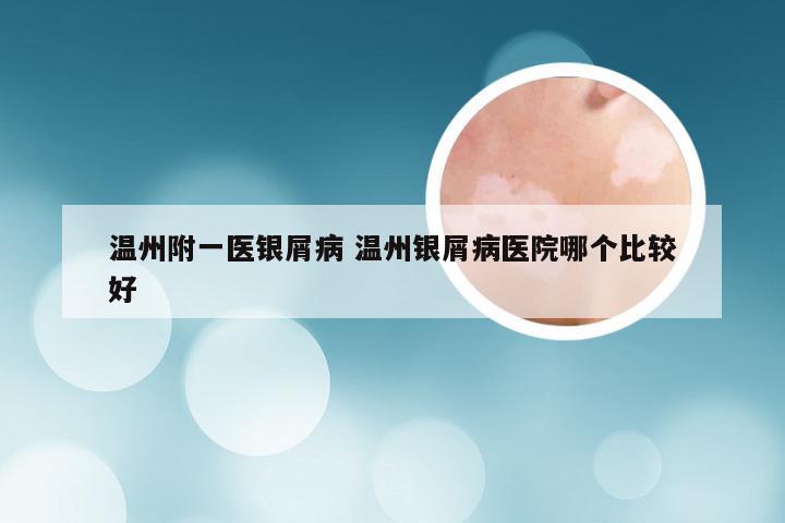 温州附一医银屑病 温州银屑病医院哪个比较好
