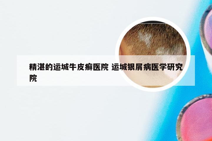 精湛的运城牛皮癣医院 运城银屑病医学研究院