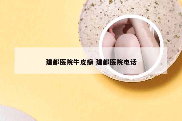 建都医院牛皮癣 建都医院电话