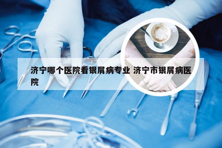 济宁哪个医院看银屑病专业 济宁市银屑病医院