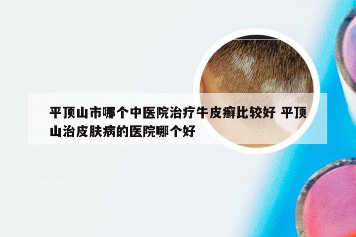 平顶山市哪个中医院治疗牛皮癣比较好 平顶山治皮肤病的医院哪个好