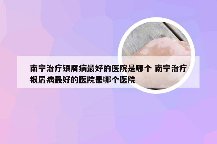 南宁治疗银屑病最好的医院是哪个 南宁治疗银屑病最好的医院是哪个医院