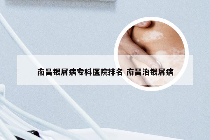 南昌银屑病专科医院排名 南昌治银屑病