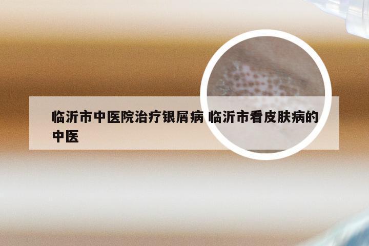 临沂市中医院治疗银屑病 临沂市看皮肤病的中医