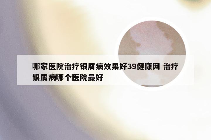 哪家医院治疗银屑病效果好39健康网 治疗银屑病哪个医院最好