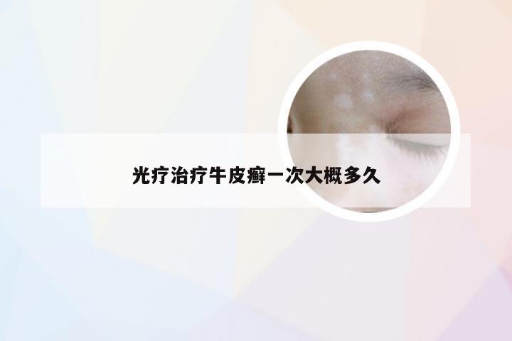 光疗治疗牛皮癣一次大概多久