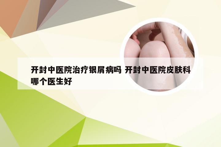 开封中医院治疗银屑病吗 开封中医院皮肤科哪个医生好