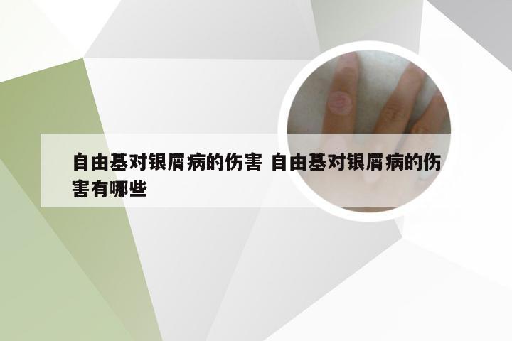 自由基对银屑病的伤害 自由基对银屑病的伤害有哪些